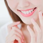 ワイヤー矯正